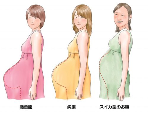 尖腹妊婦のお腹の形